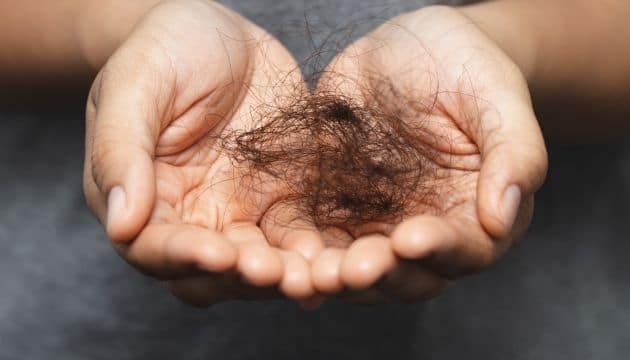 Hair-loss